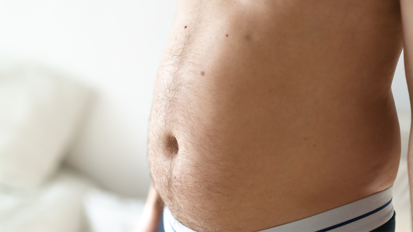 Lipolaser abdomen, espalda y pectoral (hombre)